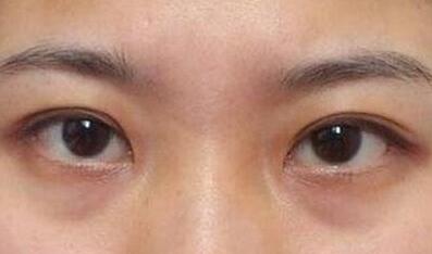 杭州東方整形吸脂到底值不值得嘗試？