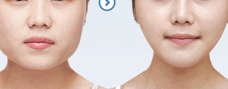 461醫(yī)院植牙科綜合評測：醫(yī)生隊伍強(qiáng)大，成功案例豐富，價格表詳解