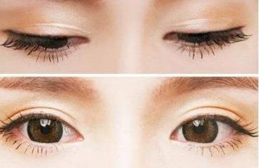 青島壹美天成整形醫(yī)院的隆鼻技術(shù)如何？看看這些真實案例！