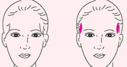 成都軍大醫(yī)院外切眼袋手術(shù)效果及評價(jià)分析