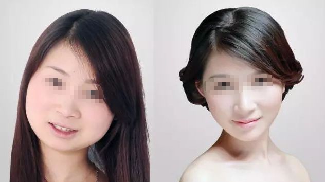 沈陽(yáng)口碑優(yōu)秀的鼻部整形診所推薦