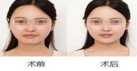 揚州隆胸專家2024榜單評選揭曉：挑選胸部整形領(lǐng)域翹楚！