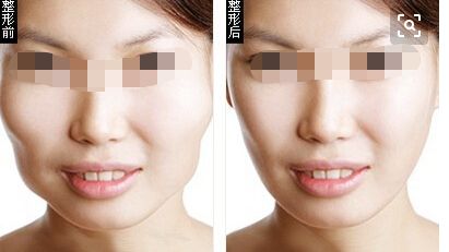 長(zhǎng)沙疤痕治療哪家醫(yī)院靠譜