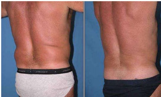 成都隆鼻專家推薦的技術(shù)排名前十，絕對讓你滿意