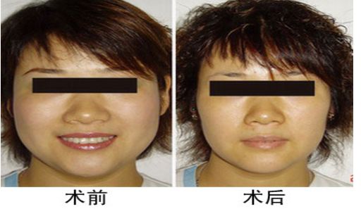 北京祛斑醫(yī)院三甲排行榜：北京哪家祛斑醫(yī)院好？