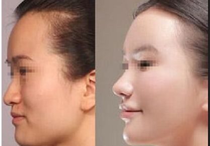 金華市有哪些優(yōu)質(zhì)整形醫(yī)院