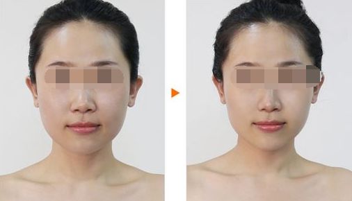 廣州哪家整形醫(yī)院好？排名前十值得推薦