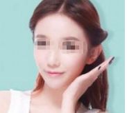 首屈一指的北京瘦身?？漆t(yī)院排行榜