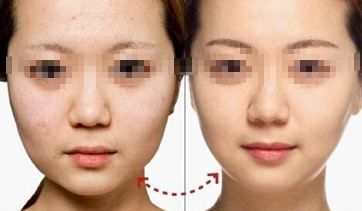 鄭州專業(yè)吸脂醫(yī)生推薦，口碑技術(shù)實(shí)力兼具！