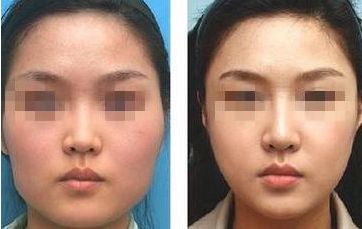 南通瘦身整形醫(yī)院哪家專業(yè)？