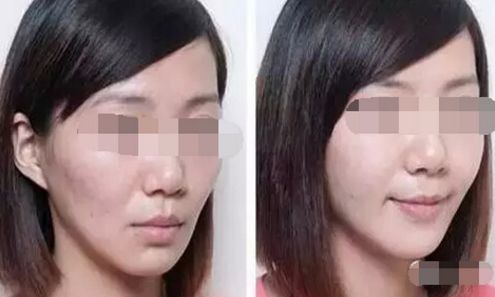 北京哪些醫(yī)院能進(jìn)行吸脂手術(shù)？