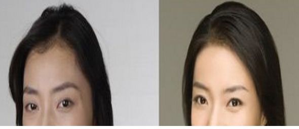 成都悅己醫(yī)美醫(yī)生實力強，顧客口碑好價格合適