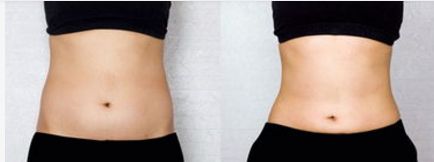 北京大學醫(yī)院眼部整形怎么樣？真實案例分享+醫(yī)生介紹