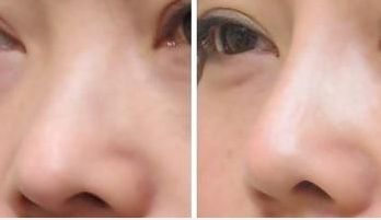 湖南熱瑪吉整形醫(yī)院綜合實力前五名亮相