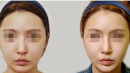 深圳七和醫(yī)美口碑如何？技術(shù)實力+醫(yī)生團隊+特色項目解析