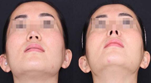 蘭州經(jīng)驗(yàn)豐富的脂肪豐胸醫(yī)生推薦：逯巖、郭曉磊、雷蓓