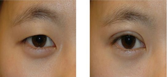 武漢最好的整形美容醫(yī)院哪家？