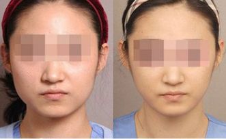 湛江有哪些頂尖整形美容醫(yī)院值得關(guān)注？