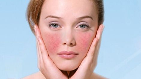 成都青羊和和至美醫(yī)療美容醫(yī)院真實口碑！最值得信賴的美容項目推薦！