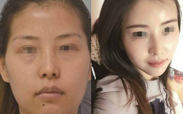 松原市哪家整形醫(yī)院效果好？