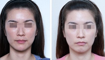 煙臺整形醫(yī)院前五強詳評：優(yōu)勢特色大比拼