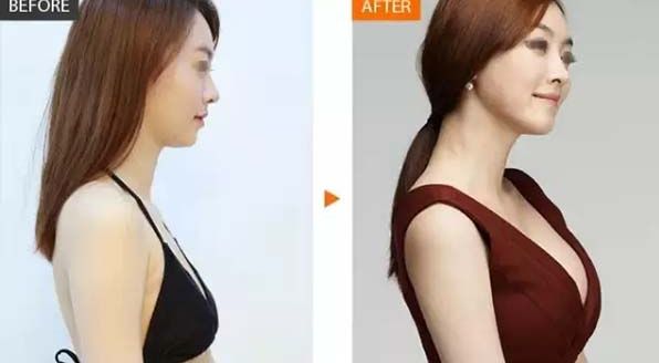 長沙哪家雙眼皮醫(yī)院排名靠前呢？