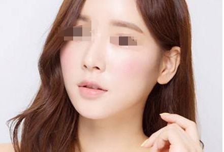 上海整形醫(yī)院中，哪家隆鼻效果好？