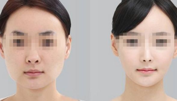 湖南省隆鼻整形醫(yī)院排行榜發(fā)布！哪家整形醫(yī)院效果好又靠譜？