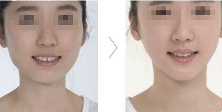 哪家醫(yī)院在北京具有卓越的醫(yī)美科技和服務(wù)？歐洲醫(yī)學(xué)中心、北京協(xié)和、北大人民醫(yī)院等公立單位有何特色？