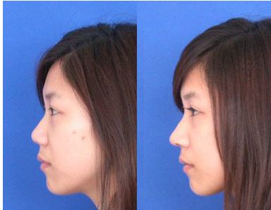 福州地區(qū)頂級(jí)整形醫(yī)院推薦