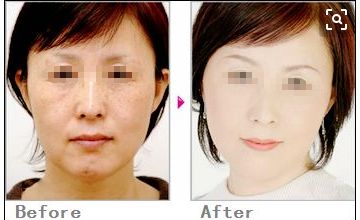 常州市前五名正規(guī)整形醫(yī)院排名及綜合評價