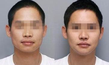 常德十大整形醫(yī)院推薦，排名公布！