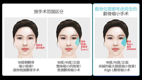 成都康橋眼科醫(yī)院美容科的評價及價格費用推薦