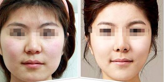 2024年廣州醫(yī)美整形醫(yī)院排行榜領(lǐng)軍十強