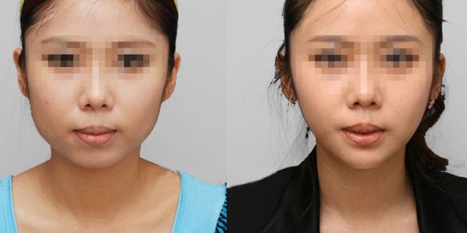 蘭州哪家整形醫(yī)院口碑好？看看排名榜單！