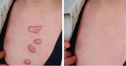 鄭州哪家整形美容醫(yī)院豐胸效果好