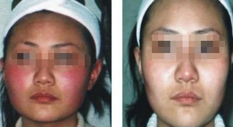 蘇州雙眼皮醫(yī)院排行榜，哪所醫(yī)院技術(shù)靠譜