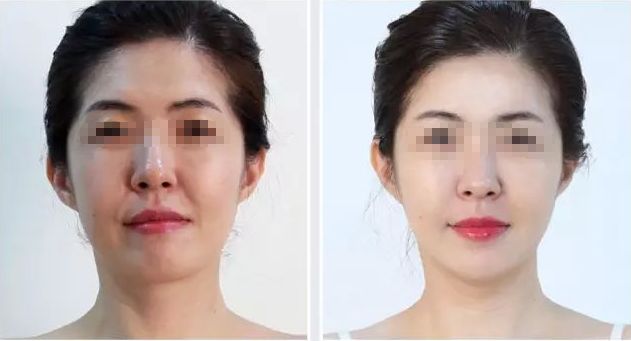 濟(jì)寧哪家整形醫(yī)院評(píng)價(jià)好，口碑排名靠前的有哪些？