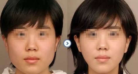 【揭秘】合肥私立整形醫(yī)院人氣TOP榜單！