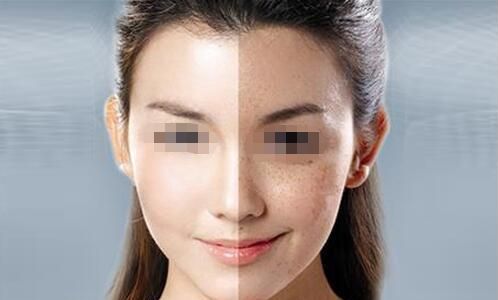 衡陽(yáng)雅美14周年慶vip專場(chǎng)：寶尼達(dá)私享會(huì)，玻尿酸買2送2優(yōu)惠限時(shí)開啟