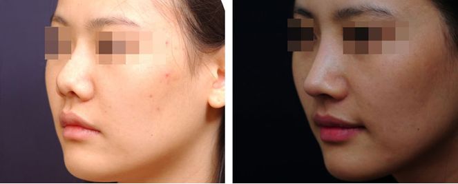 福建整形醫(yī)院TOP10評(píng)選結(jié)果即將揭曉