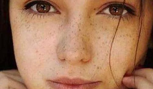 常德雙眼皮手術哪家醫(yī)院靠譜