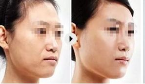 上海頂尖美容整形醫(yī)院精選，讓你真正了解排行榜