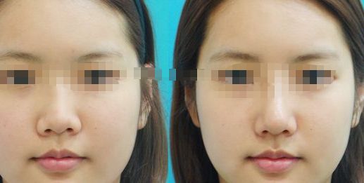 成都市吸脂手術在哪兒可以做？