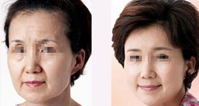 柳州市人民醫(yī)院整形科優(yōu)質(zhì)服務(wù)，專設(shè)專業(yè)咨詢及手術(shù)設(shè)施