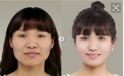 梅州皇佳貝麗整形醫(yī)院2023全新提升，醫(yī)療技術(shù)引領(lǐng)新潮流