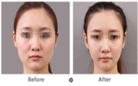 南京受歡迎的雙眼皮醫(yī)院綜合推薦