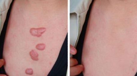 達州市整形醫(yī)院綜合評測及專家推薦