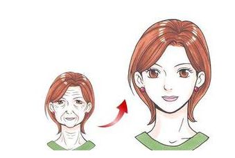 虞冬梅醫(yī)生雙眼皮修復效果分享：手術(shù)后真實圖賞析