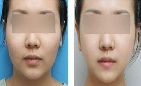 武漢亞韓整形外科醫(yī)院口碑如何？先進醫(yī)療技術(shù)吸引普遍關(guān)注！